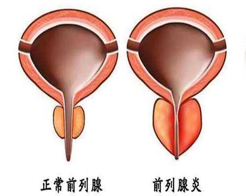 上海弱精症试管