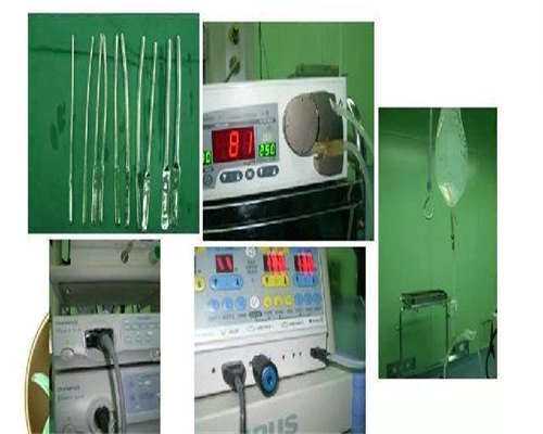 子宫肌瘤试管上海